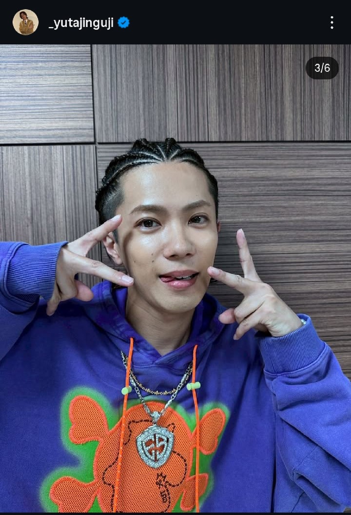 Number_i 神宮寺勇太、コーンロウ祭りだ!これでもかとばかりにオフショット大量投稿、ファン「コーンロウぐうじさんだらけ～」